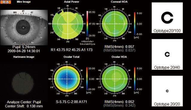 EU_Photos_Products_KR_1W_640_480_q_Topcon_KR-1W_Refractive_Surgery.jpg