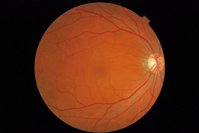 EU_Photos_Products_TRC_NW8series_640_480_q_TRC-NW8_fundus.jpg