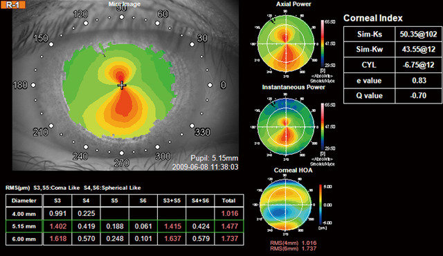 EU_Photos_Products_KR_1W_640_480_q_Topcon_KR-1W_Corneal_Maps.jpg