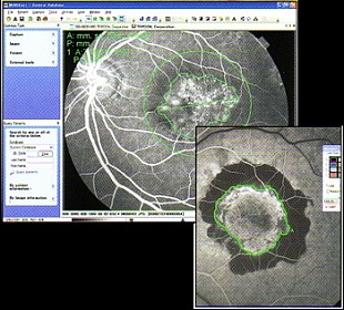 IMAGEnet